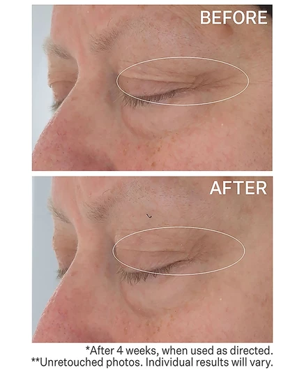 Крем-гель для глаз StriVectin Hyaluronic Tripeptide, 15 мл